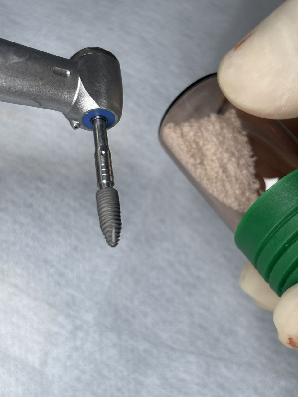 Implantes Dentários