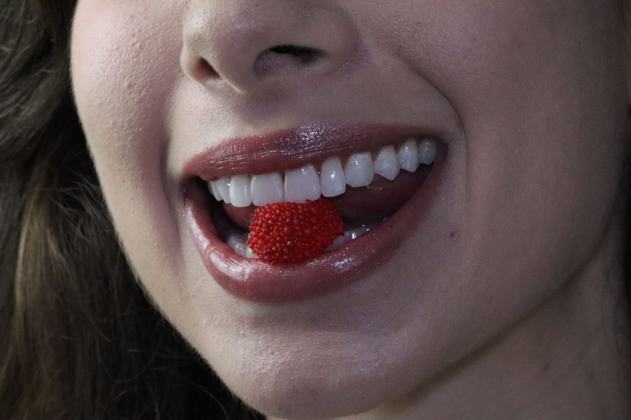 Estética Dental